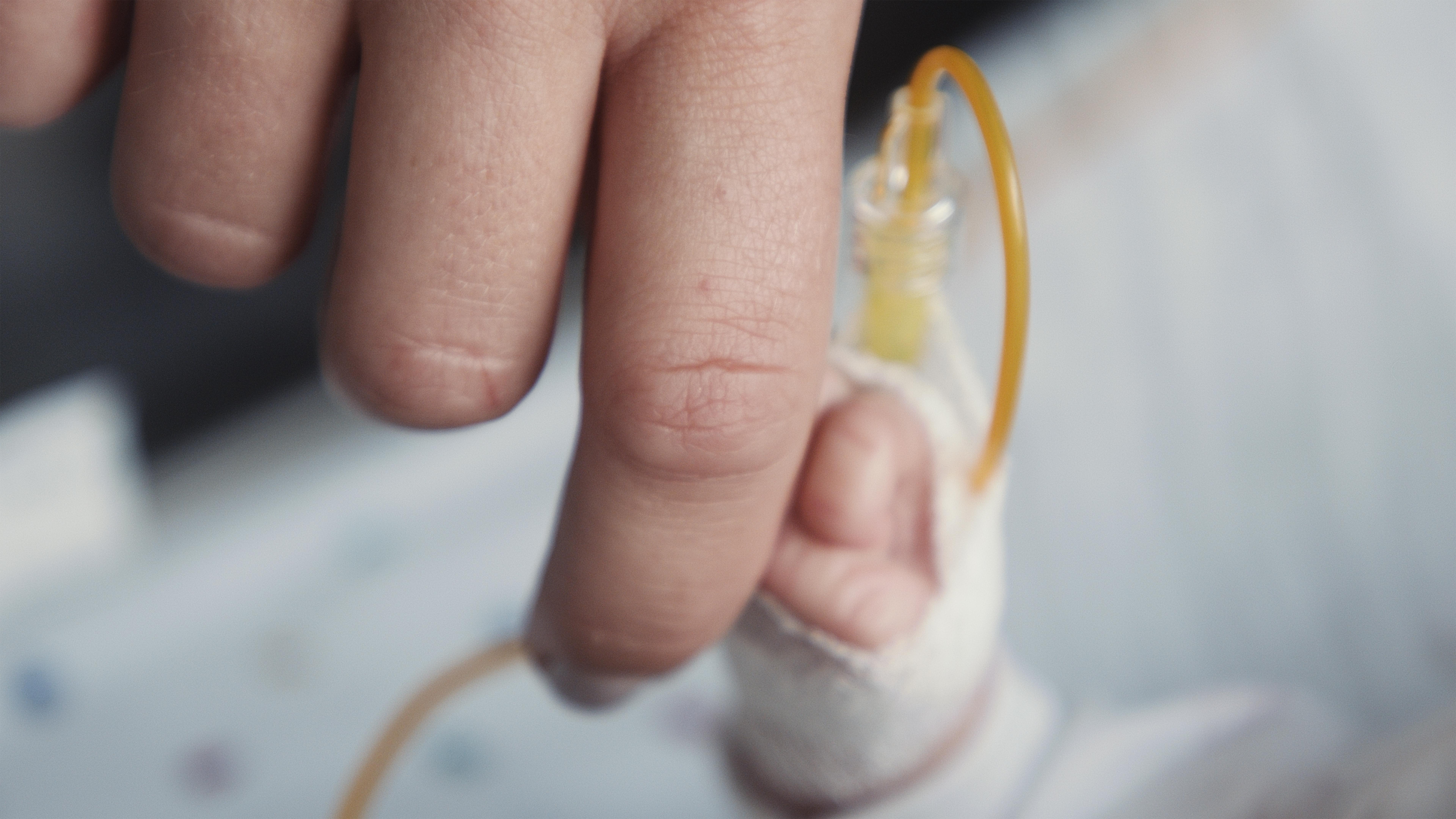 premature infants neonatology hands